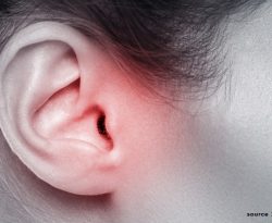 Single application cold-chain independent drug delivery system for outer ear infections