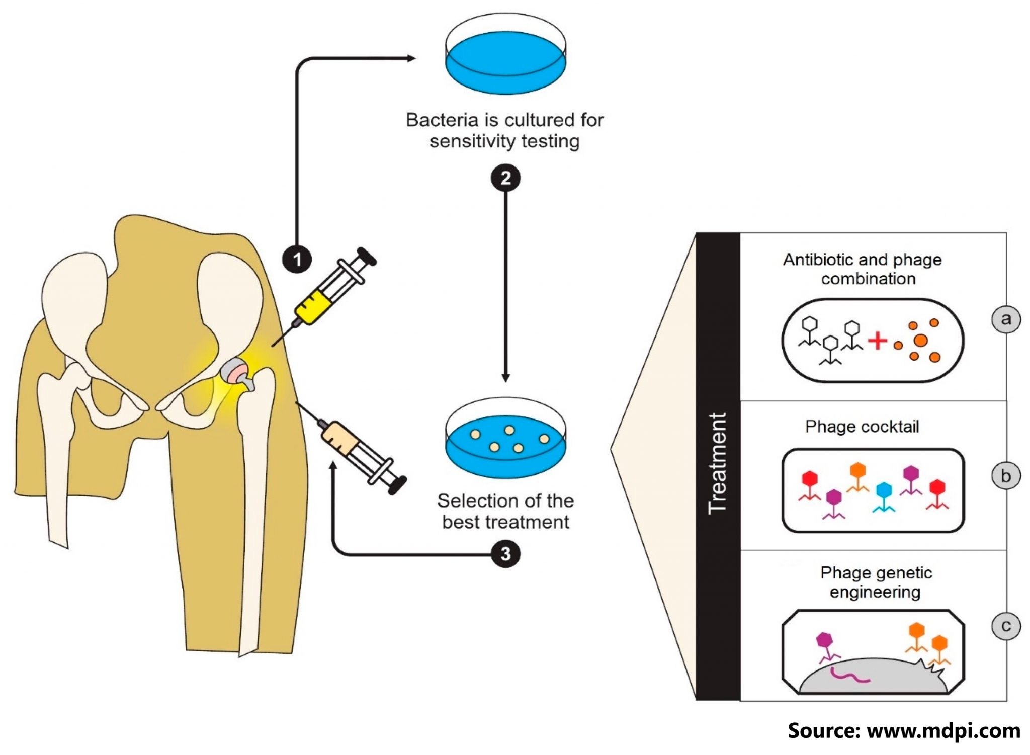 Bacteriophageantibiotic combination therapy against extensively drug